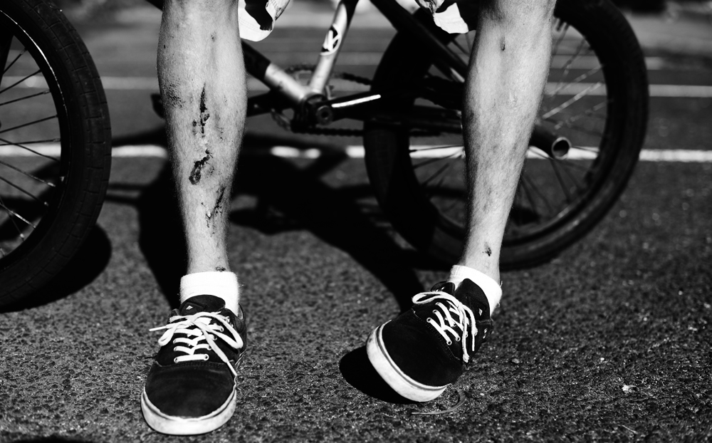 tiny-shins